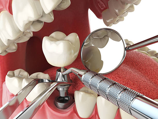 Best Emergency Dental Services for Seniors in South Point, OH